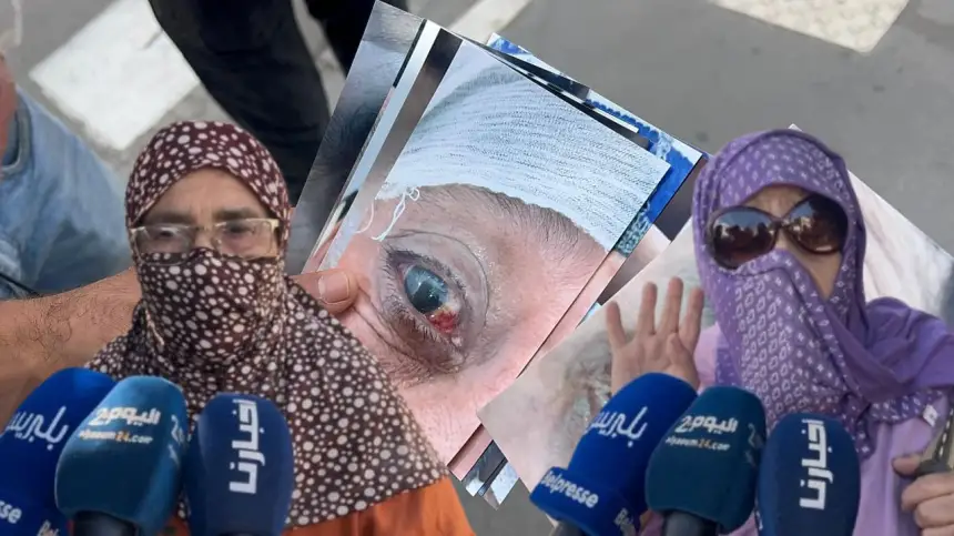 ضــحايا حقن 20 غشت الفاسدة يصرخون: نريد محاكمة المتورطين بعدما أفقدونا البصر